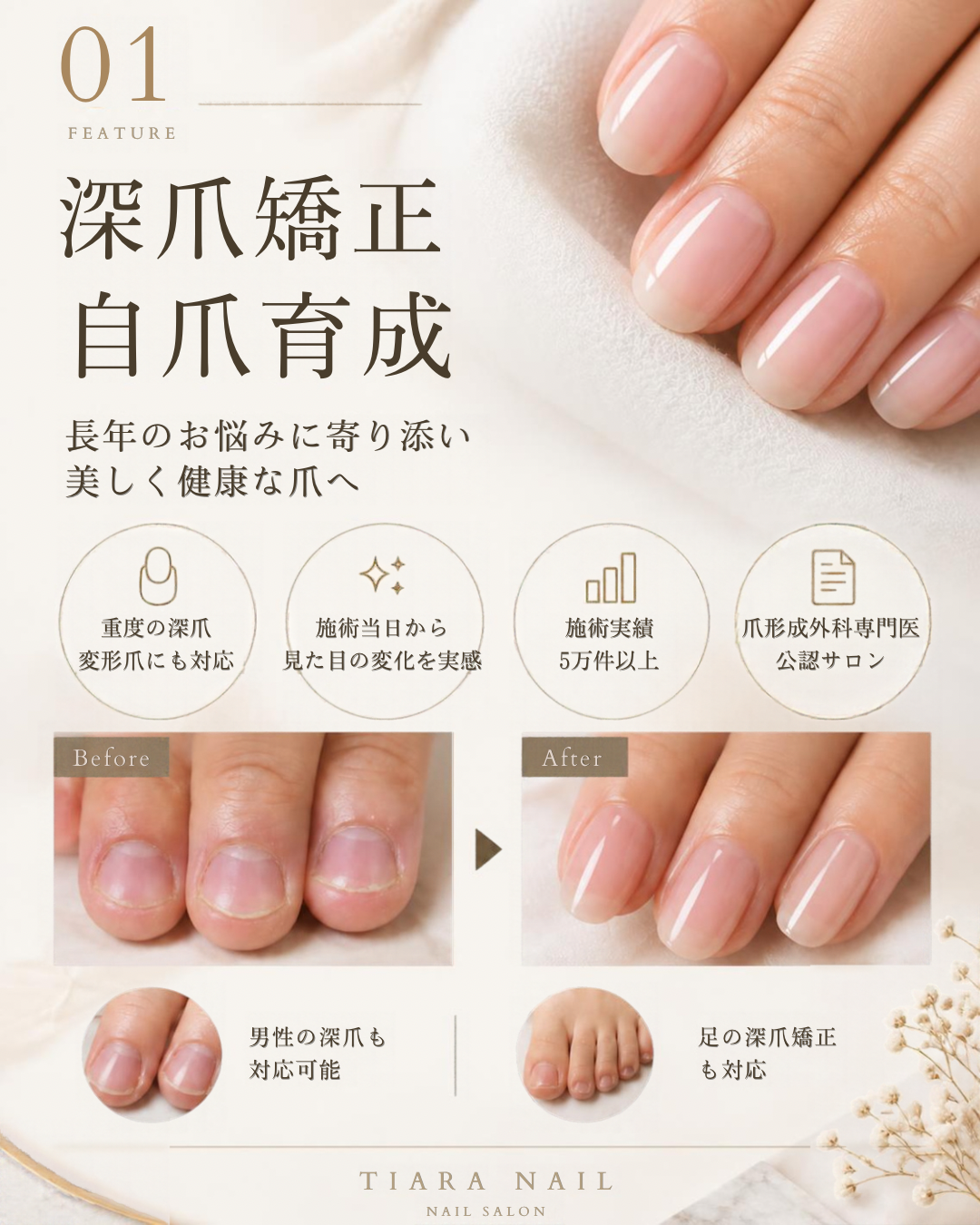 【再発させない深爪矯正・自爪育成専門店】